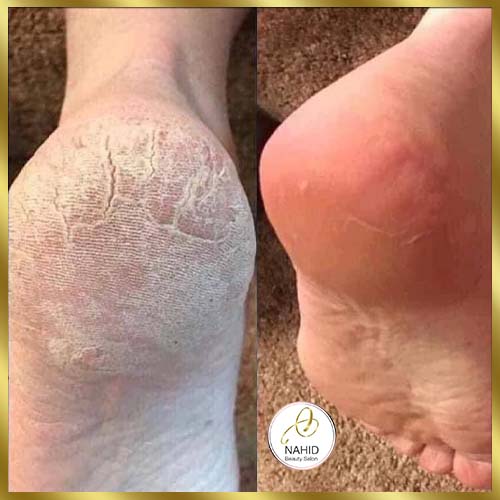 گالری پدیکور